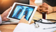 Lung scan on a tablet. Photo: Prapass Pulsub/Getty Images