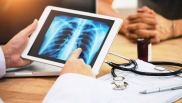 CMS expands coverage of lung cancer screening with low dose computed tomography